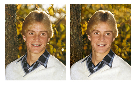 Removing a Young Man's Braces on a Photograph-by Kathryn Rutherford-Heirloom Art Studio